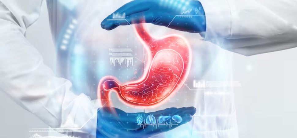 Rectal Cancer
